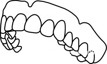 Dental dentist clipart black and white free clipart images 2