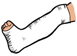 Leg in a plaster cast clipart cliparts for you