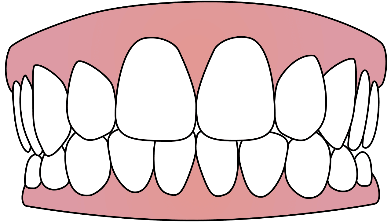 Teeth dental clipart picture