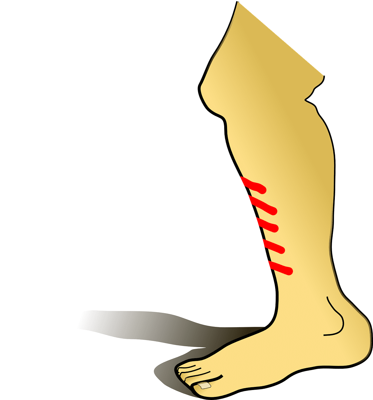 Feet shin splints whole body health physical therapy portland oregon clipart photo