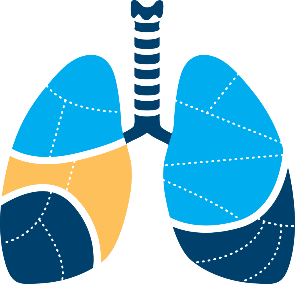 Lungs lung cancer treatments research foundation clipart free