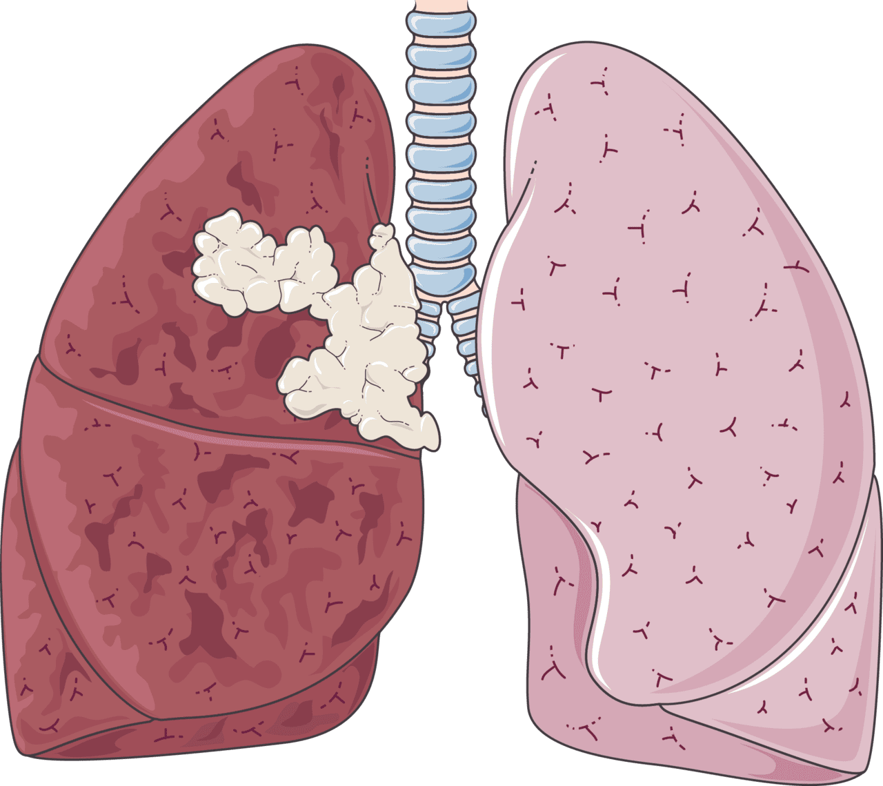 Lungs medical art clipart clip art