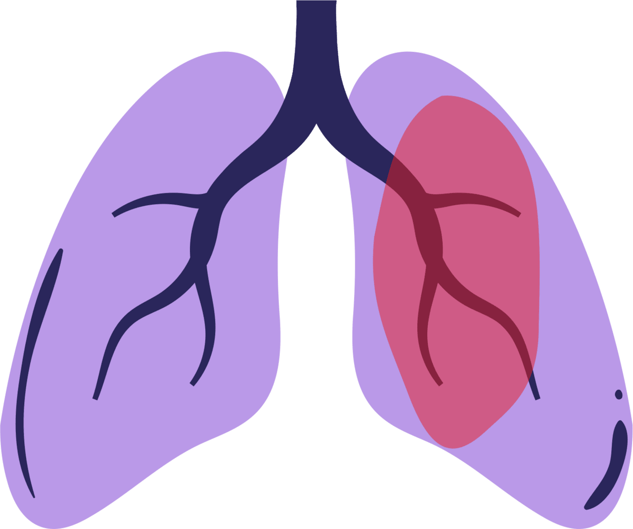Lungs simple guide to understand cancer part clipart image