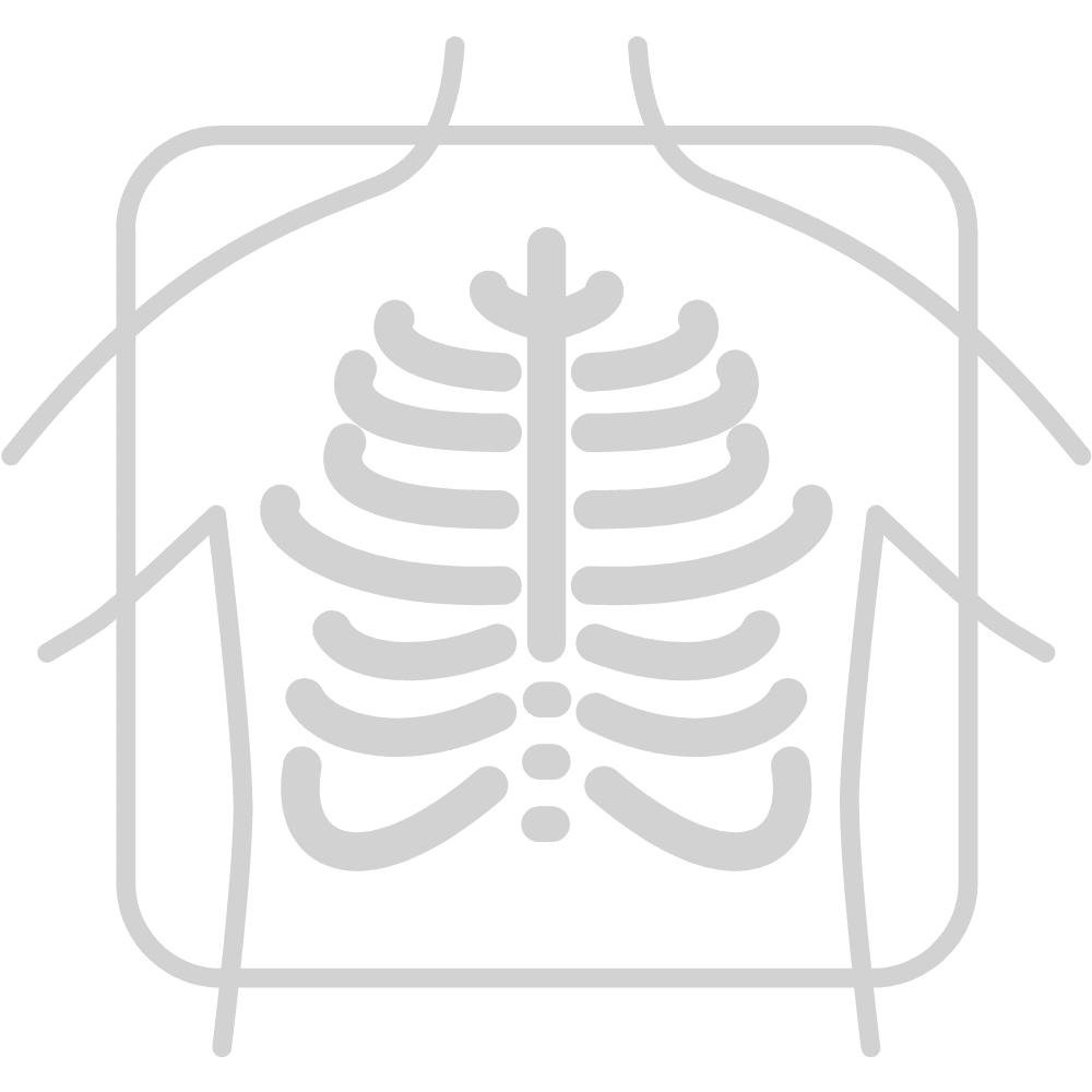 Ray clipart medical radiology graphics free