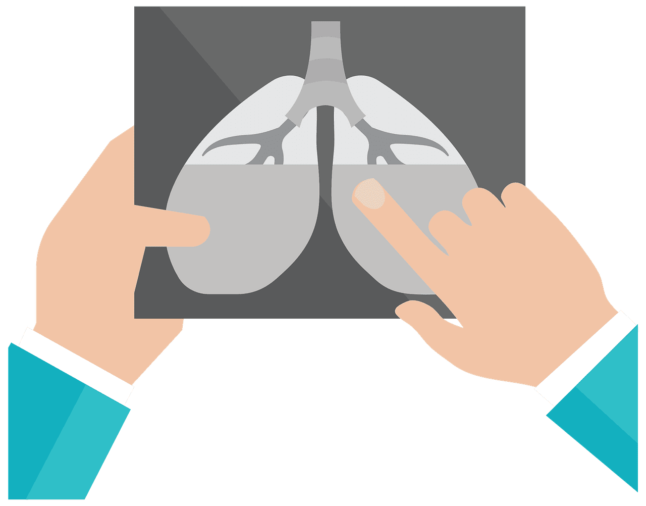 Examining an ray of the lungs vector clipart images