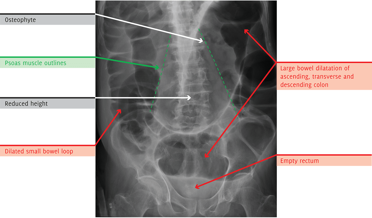 Ray clipart medical radiology image