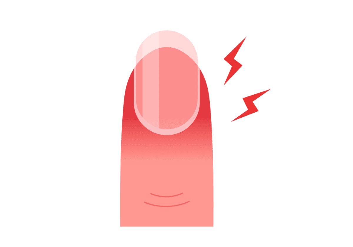 Finger nail pain symptoms causes mon questions buoy clipart photo