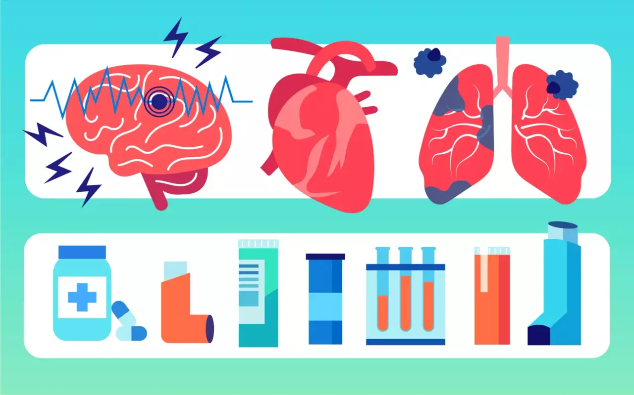 Kidney what conditions qualify for medicare chronic care management ccm clipart vector